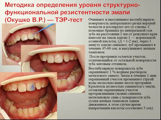 https://prezentacii.org/upload/cloud/19/03/134920/images/screen39.jpg